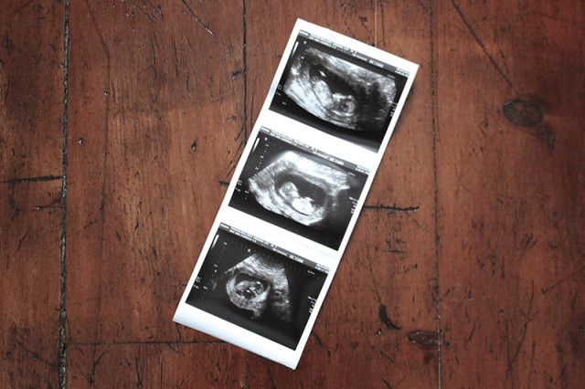 second-baby-ultrasound